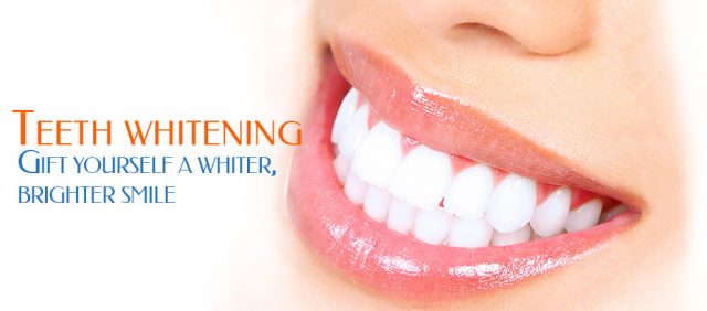 teeth-whiting-